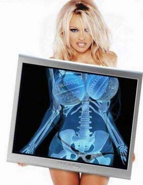 Pamela XRay picture