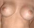 Real or Fake Tits