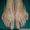Funny pictures of wierd hairy feet with too many toes